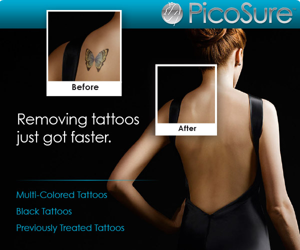 Tattoo Removal London  Tattoo Removal Experts